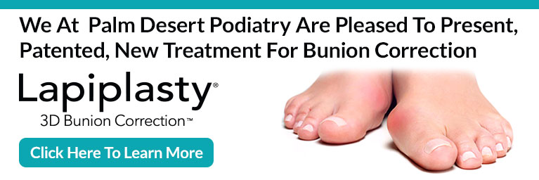 Lapiplasty 3D Bunion Correction