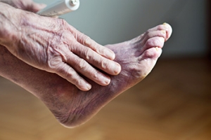 Improving Poor Circulation in the Feet
