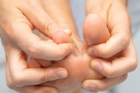 Signs and Causes of Athlete’s Foot