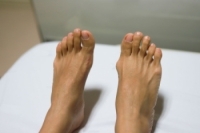 Recognizing the Early Signs of Bunions